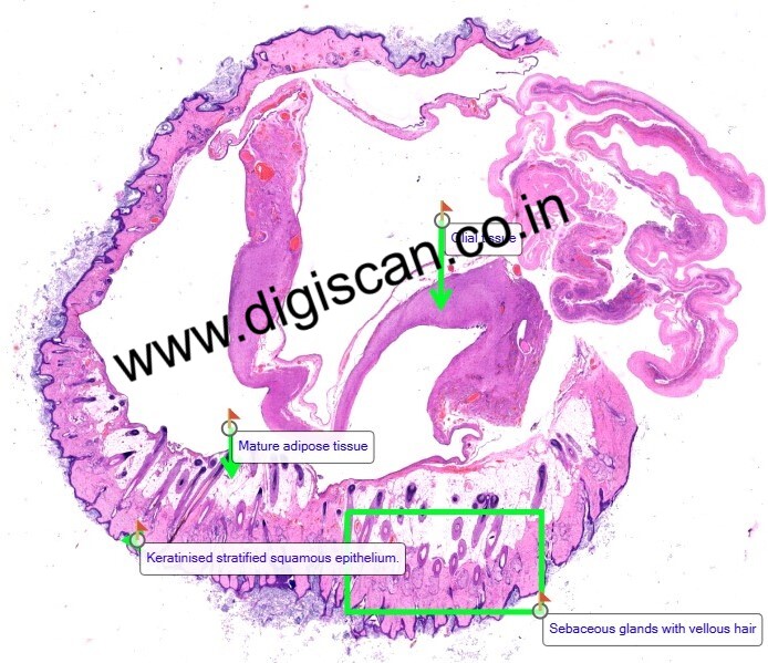 MBBS General Pathology Digital Slides Set (Microscopic Pathology)